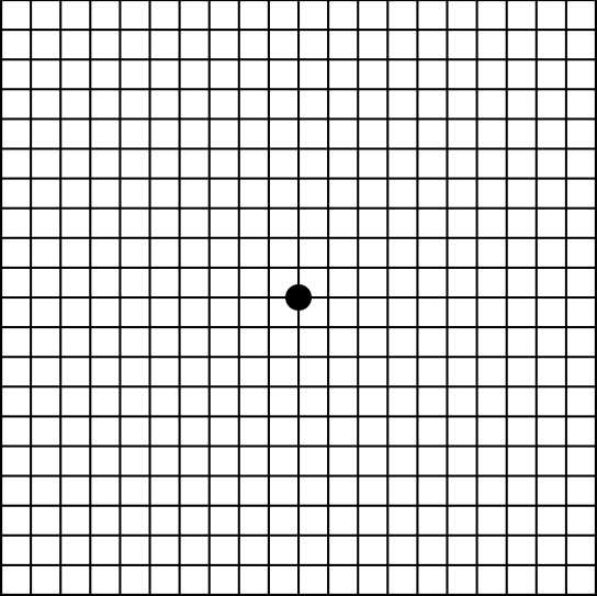 Macular Degeneration Test: How To Use The Amsler Grid